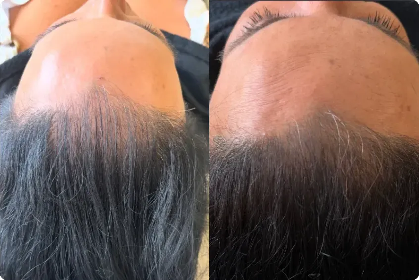 Evolução visível do tratamento capilar